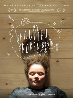 Xem phim My Beautiful Broken Brain - Khối Óc Xinh Đẹp Tội Nghiệp Của Tôi 2014 Full HD Vietsub